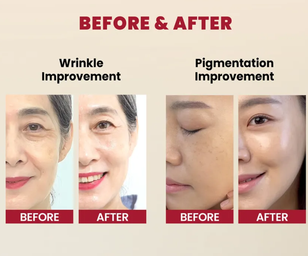 KSECRET - SEOUL 1988 Serum : Retinal Liposome 2% + Black Ginseng - Image 4