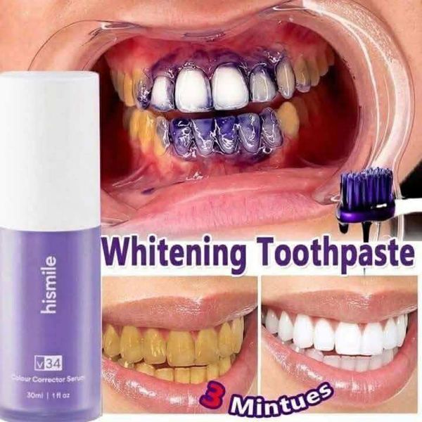 🦷💜 𝐇𝐢𝐬𝐦𝐢𝐥𝐞s 𝐕𝟑𝟒 𝐂𝐨𝐥𝐨𝐫 𝐂𝐨𝐫𝐫𝐞𝐜𝐭𝐨𝐫 💜🦷