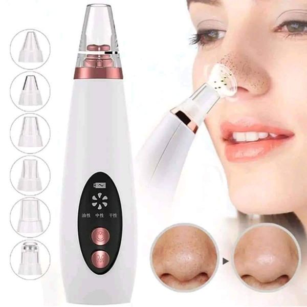black head removal machine
