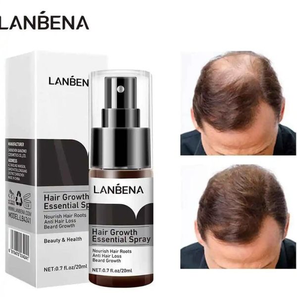 LANBENA GROWTH ESSENCE SPRAY