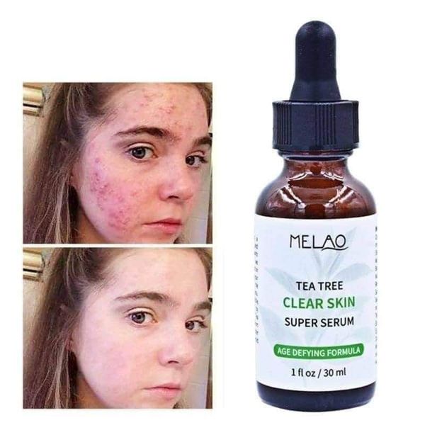 MELAO Tea tree clear skin serum