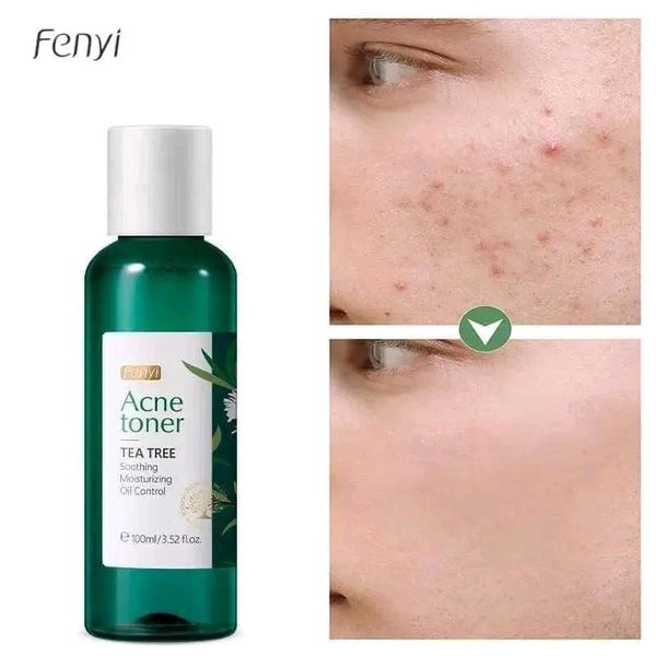 Fenyi Acne Toner Tea tree 100ml